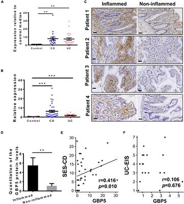 The Proinflammatory Role of Guanylate-Binding Protein 5 in Inflammatory Bowel Diseases